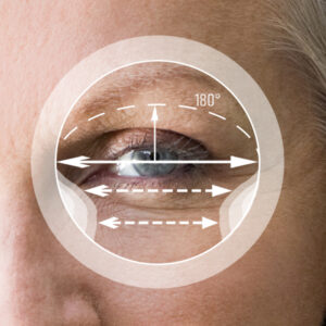 MULTIFOCAL PROGRESIVO AMPLIO 180ver2